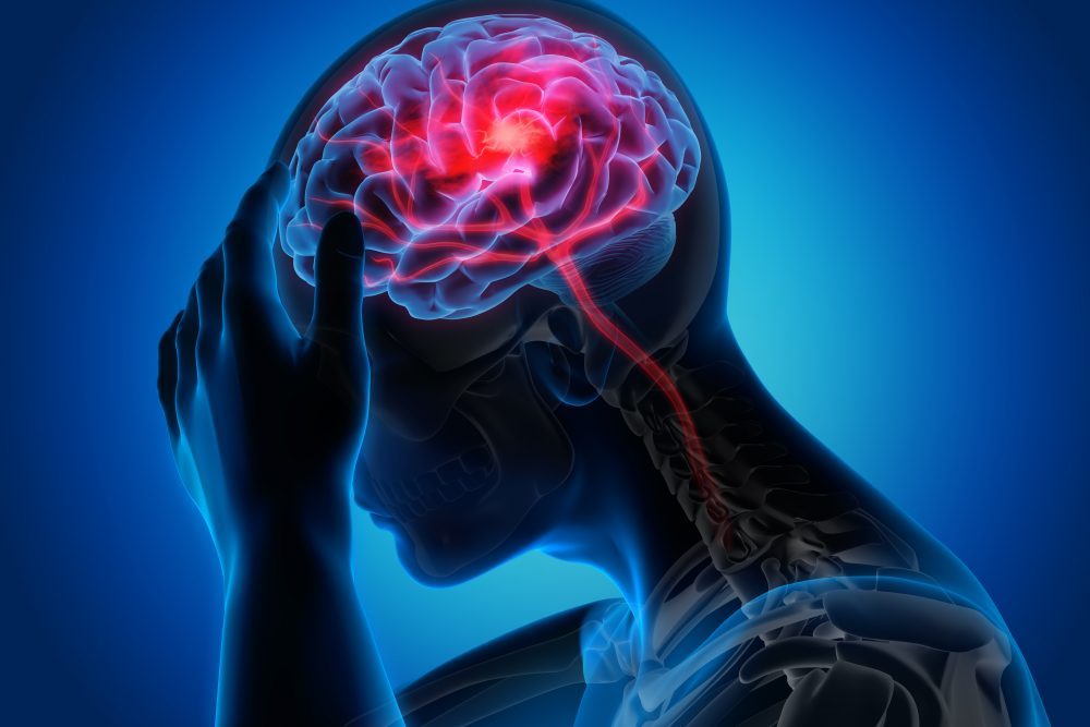 Migren Nedir? Nedenleri ve Belirtileri Nedir?